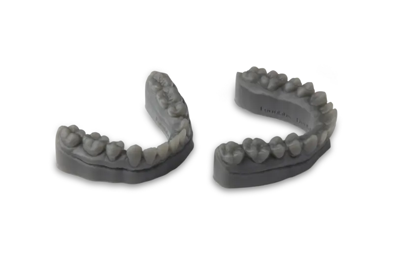 3D Printed Models Valeri Orthodontics