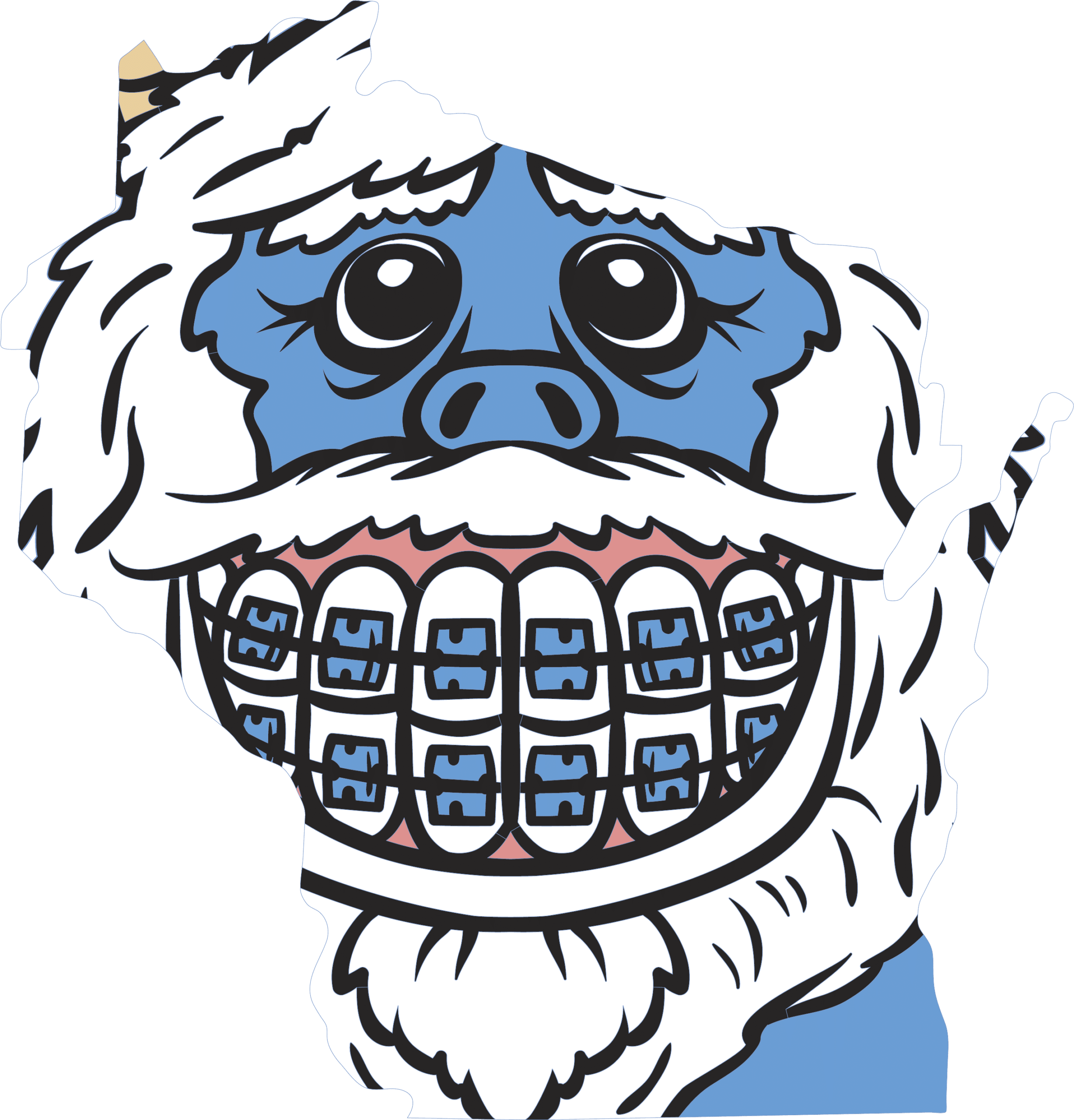 Wisconsin Yeti with braces — Valeri Orthodontics